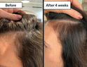 Hair Renew