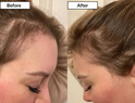 Hair Renew