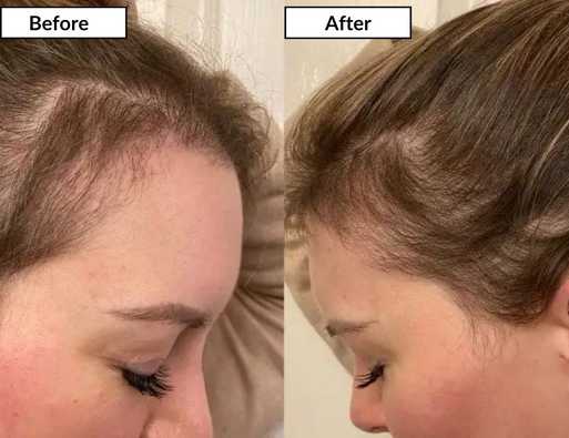 Hair Renew